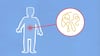 Cyclospora Infection Is Spreading Rapidly; Know Why It Causes Severe Diarrhoea