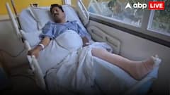 बेंगलुरु में खुले नाले में गिरकर घायल हुए BJP नेता, मंत्री और MLA के खिलाफ शिकायत दर्ज