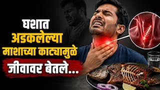 Navi Mumbai : घशात अडकलेल्या माशाच्या काट्यामुळे जीवावर बेतले; नवी मुंबईतील मेडिकव्हरमध्ये दोन रुग्णांवर यशस्वी उपचार