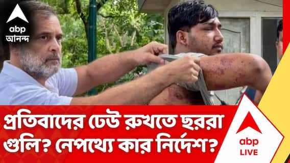 CJP Protest | কার নির্দেশে চলল ছররা গুলি? পুলিশের ভূমিকায় তপ্ত রাজধানীর রাজনীতি
