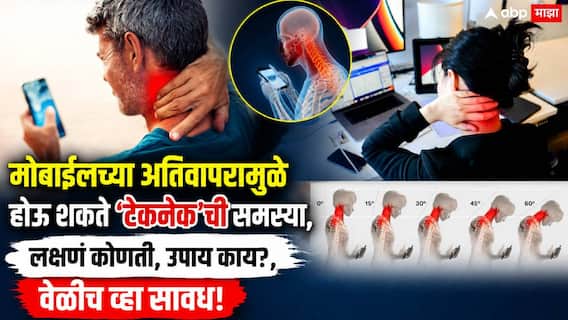 Tech-Neck Problem Health News: मान झुकवून फोन, लॅपटॉप पाहिल्यानं येतो 22 किलोंचा भार; मोबाईलच्या अतिवापरामुळे होऊ शकते 'टेकनेक'ची समस्या Tech-Neck Problem Health News: मान झुकवून फोन, लॅपटॉप पाहिल्यानं येतो 22 किलोंचा भार; मोबाईलच्या अतिवापरामुळे होऊ शकते 'टेकनेक'ची समस्या