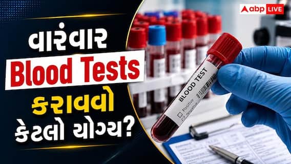Unnecessary Blood Tests: શું તમે પણ વારંવાર કરાવો છો બ્લડ ટેસ્ટ? જાણો નુકસાન Unnecessary Blood Tests: શું તમે પણ વારંવાર કરાવો છો બ્લડ ટેસ્ટ? જાણો નુકસાન