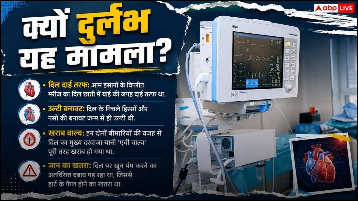 Robotic Valve Replacement: सफदरजंग का विश्व रिकॉर्ड, रोबोट से की अनोखी हार्ट सर्जरी