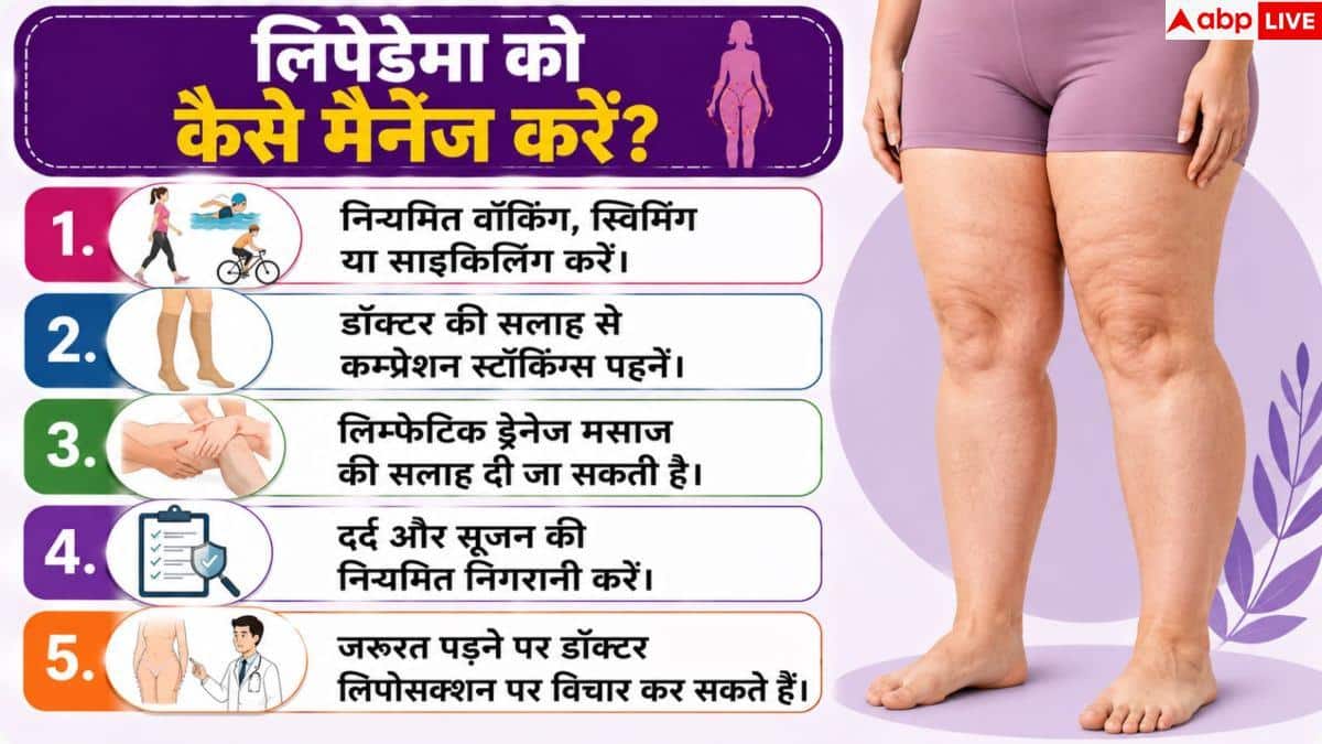 Lipedema Symptoms: जांघ की चर्बी को न मान लेना नॉर्मल फैट, हो सकती है यह बीमारी