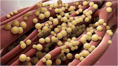 High Cholesterol Warning Signs : కొలెస్ట్రాల్ ఎక్కువగా ఉండొచ్చని సూచించే సంకేతాలు ఇవే.. అధిక కొవ్వుని లైట్ తీసుకోకండి