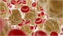High Cholesterol Warning Signs : కొలెస్ట్రాల్ ఎక్కువగా ఉండొచ్చని సూచించే సంకేతాలు ఇవే.. అధిక కొవ్వుని లైట్ తీసుకోకండి
