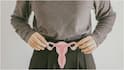 PCOD/PMOS Diet : PCOD, PMOS ఉన్న అమ్మాయిలకు రోజూ ఇవ్వాల్సిన సూపర్‌ఫుడ్స్ ఇవే.. హార్మోన్ల సమతుల్యతకు మేలు చేస్తాయట