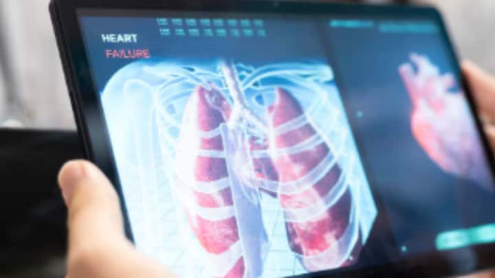 ধূমপান করলেও অ্যাসবেস্টসsj (Asbestos) সংস্পর্শে না এলে ঝুঁকি কম হয় ঘরবাড়ি তৈরিতে ব্যবহৃত হয় অ্যাসবেস্টস। শরীরে প্রবেশ করলে স্থায়ী ভাবে ফুসফুসে আটকে যেতে পারে। অ্যাসবেস্টসের সংস্পর্শে আসার ১৫ বছর পরও ফুসফুসের ক্যান্সার হতে পারে কারও।