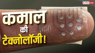 वैज्ञानिकों का कमाल! खुद टूटकर जुड़ जाएगी ये इलेक्ट्रॉनिक स्किन, जानें टेक्नोलॉजी